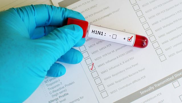 H1N1 -ის ვირუსით 66 წლის მამაკაცი გარდაიცვალა