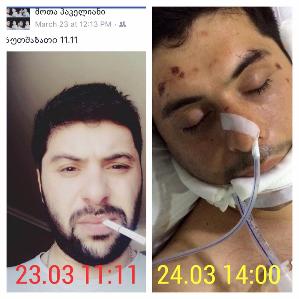 შოთა პაკელიანმა დაცემისას მუხლის და იდაყვის დაზიანება მიიღო, თავის არეში დაზიანებები კი ბლაგვი საგნით აქვს მიყენებული - ადვოკატი