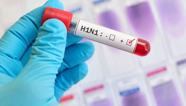 სავარაუდოდ H1N1 ვირუსით 33 წლის მამაკაცი გარდაიცვალა