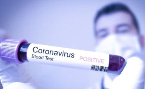 საქართველოში COVID-19-ით ინფიცირებულთა რაოდენობა 66 პაციენტამდე გაიზარდა