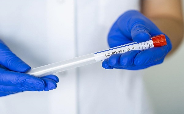 COVID-19-ით გამოჯანმრთელებულ ადამიანებს განმეორებით PCR ტესტებს აღარ ჩაუტარებენ