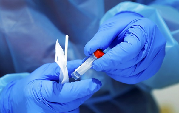 ინფიცირების შემთხვევების მატების გამო, დღეს ბათუმში კორონავირუსზე უფასო PCR ტესტირება ჩატარდება